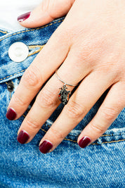 Anello Anatomia